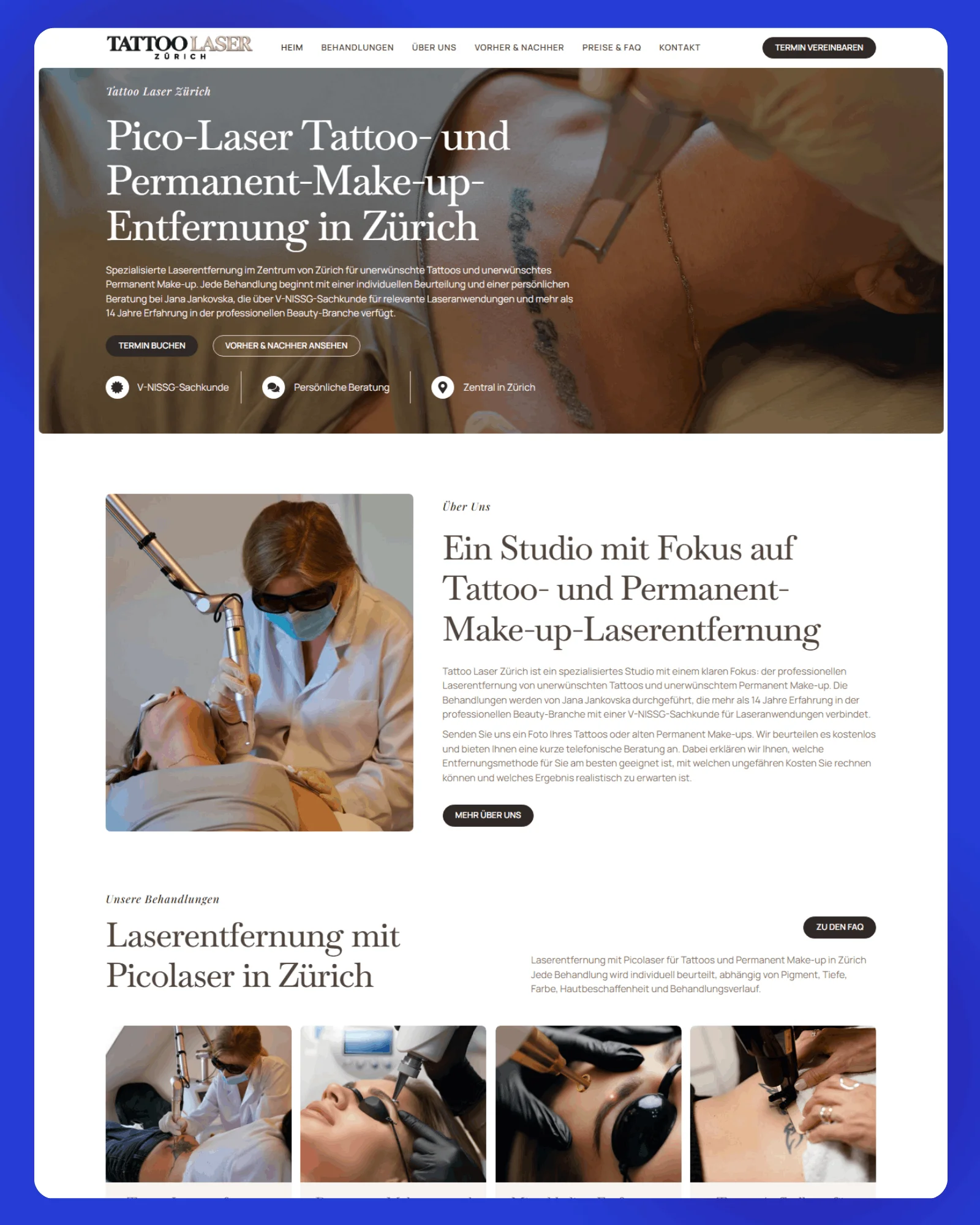 Tattoo Laser Zurich Website 5