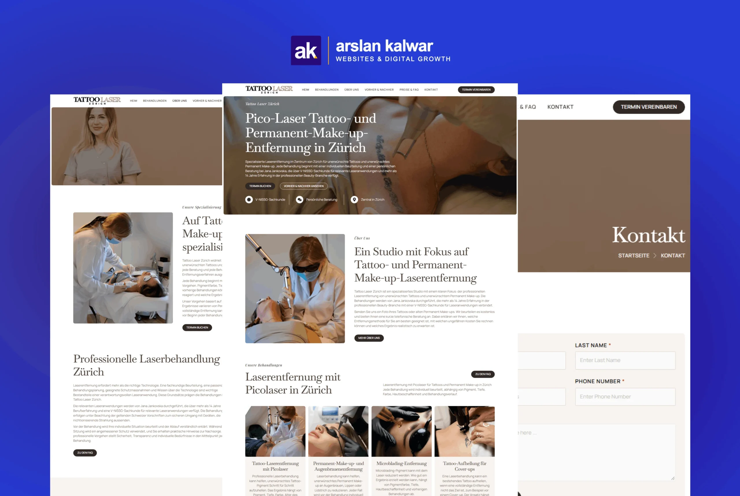 Tattoo Laser Zurich — Professional Laser Tattoo Removal PMU Removal Services Zurich Switzerland Website Design 1 scaled